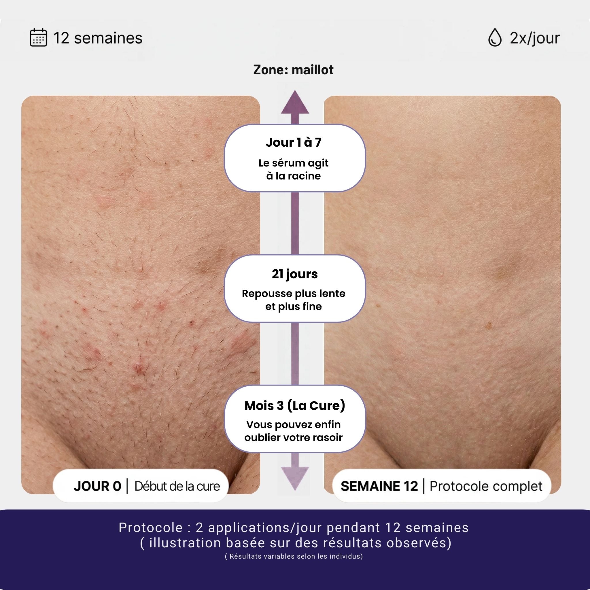 Siero Naturale Anti-Ricrescita