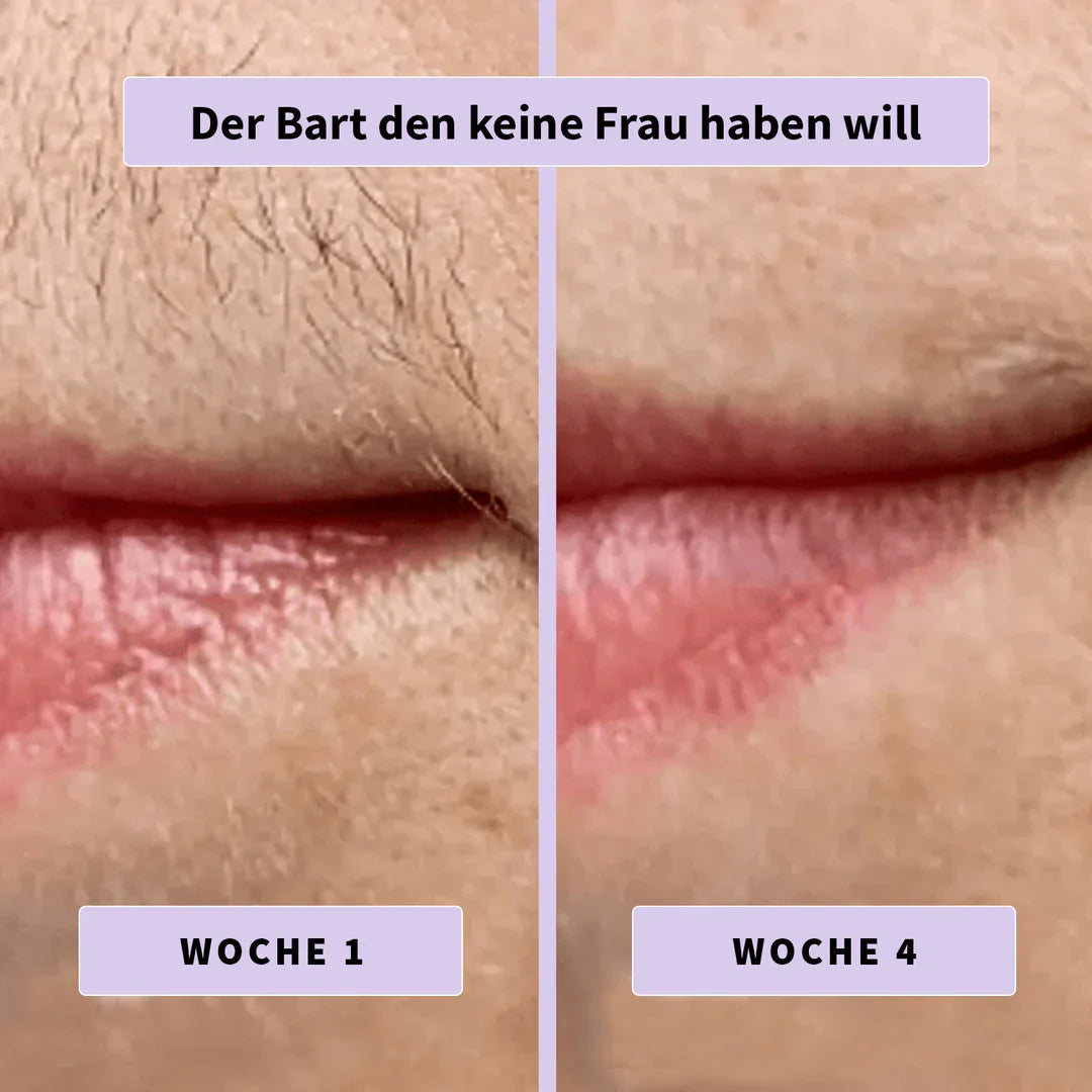 Sérum Anti-Repousse Doucyne