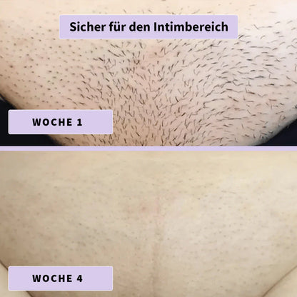 Sérum Anti-Repousse Doucyne